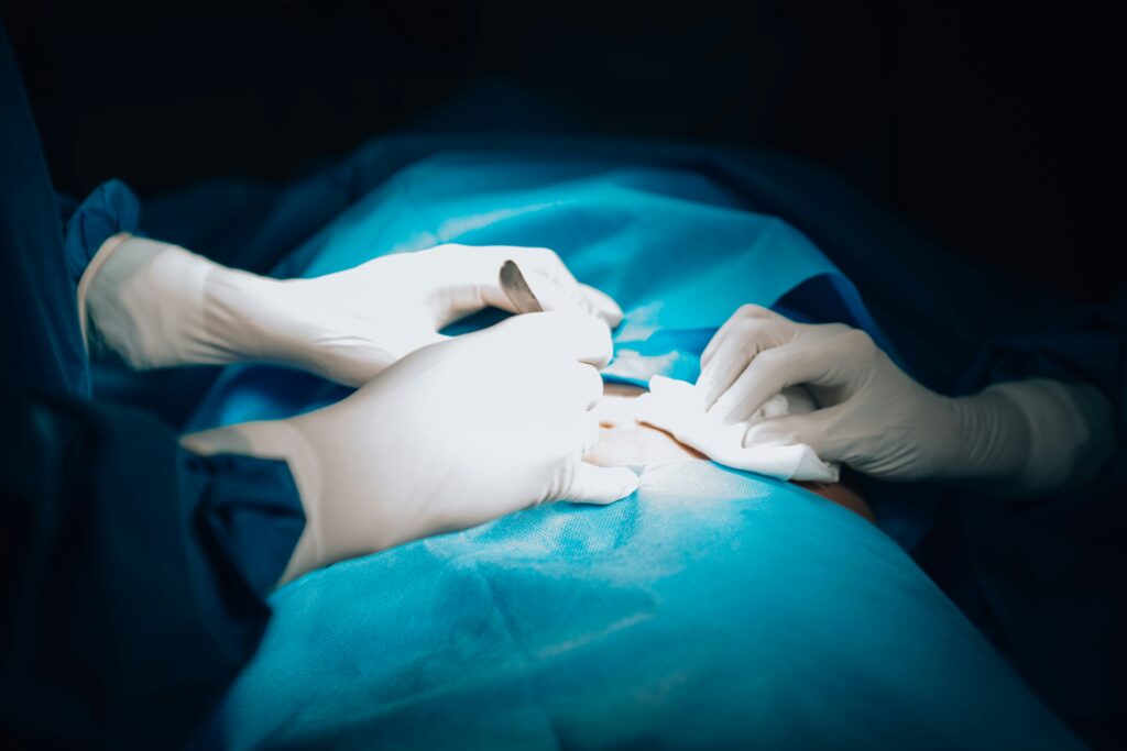 Hernia Surgery Recovery Time guide to recovery stages, surgical aftercare, physical activity, common symptoms, and healthy healing.