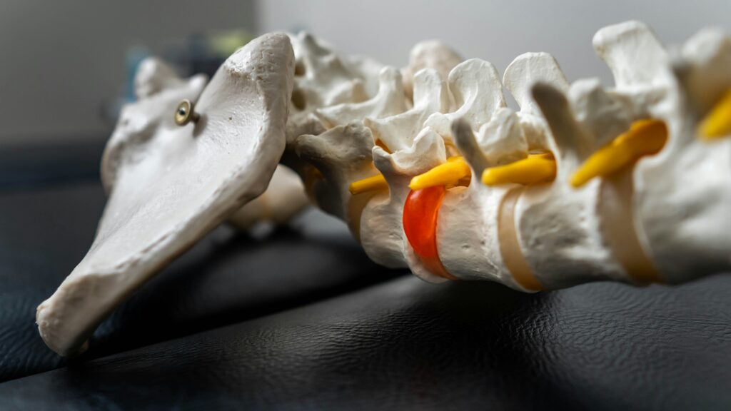Kyphoplasty covering spinal fracture treatment, recovery, benefits, complications, and patient care.