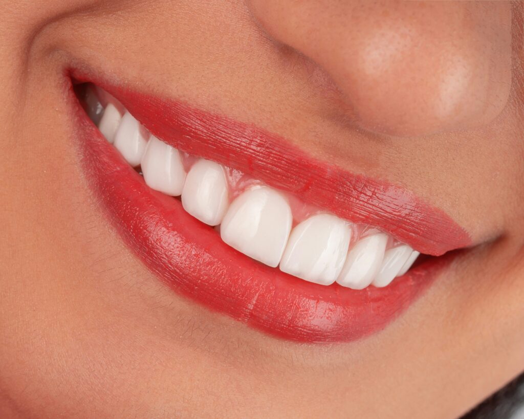 Dental illustration showing gum inflammation localized around a single back tooth.
