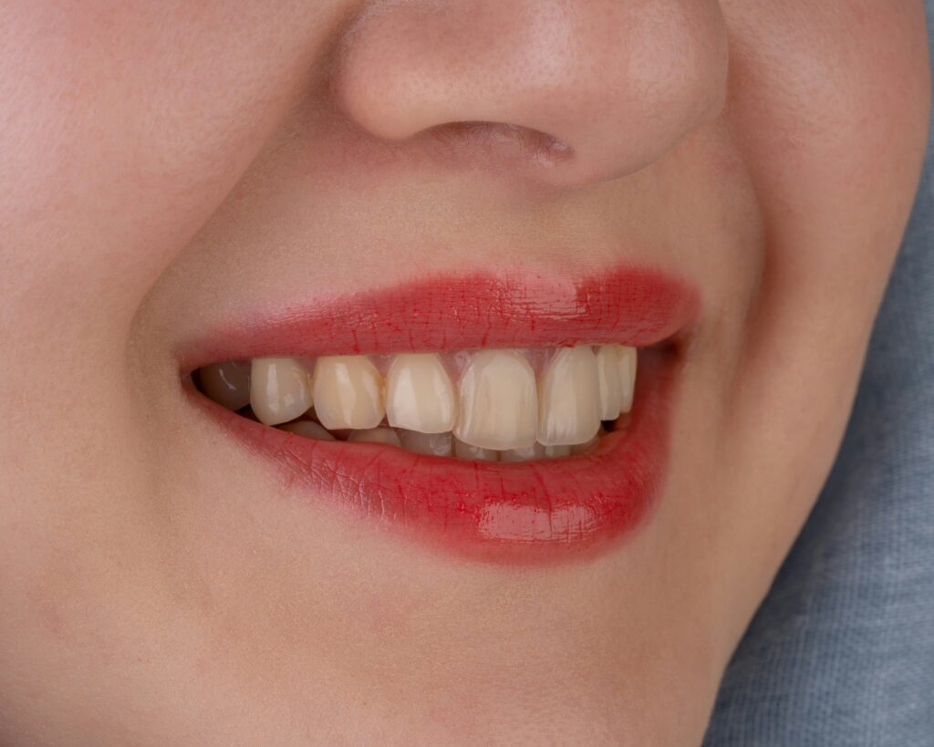 How to Reduce Swelling After Wisdom Teeth Removal covering home remedies, inflammation control, post-extraction care, healing tips, and recovery guidance.