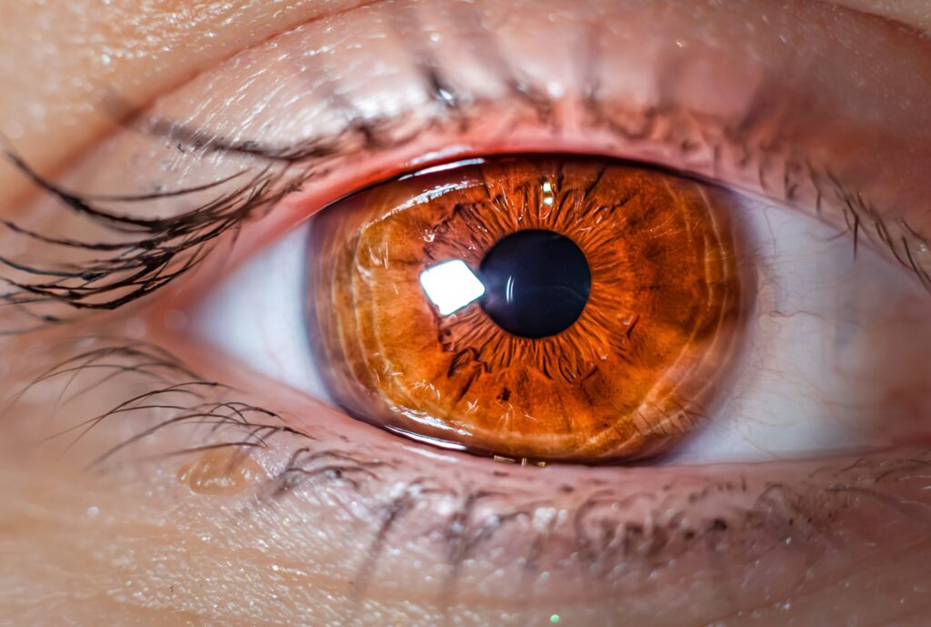 Things to Avoid with Retinal Detachment covering post-treatment care, healing tips, activity restrictions, vision protection, and eye health.