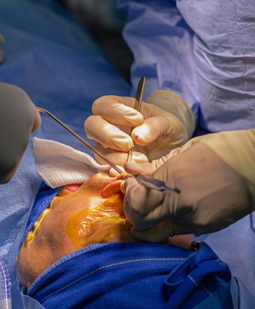 How to Fix a Deviated Septum Without Surgery with practical tips for better breathing and symptom relief.