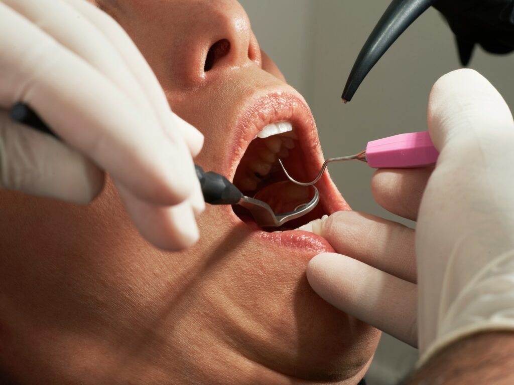 How Long Does Numbness Last After Filling? Dental Recovery Guide showing local anesthesia, dental numbness, recovery time, and post-treatment care.
