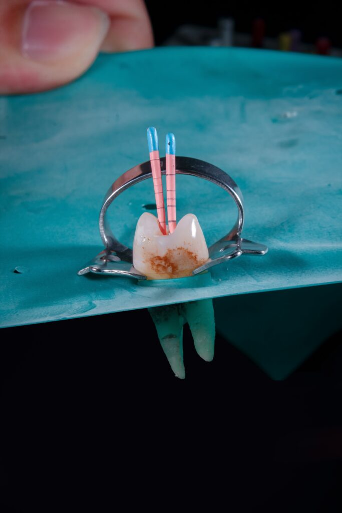 How Long to Wait to Eat After Composite Filling Post-Care Guide featuring eating precautions, food choices, filling care, sensitivity, and dental recovery.