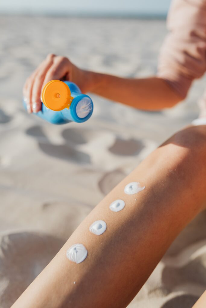 Why does my sunburn itch so bad and what may help
