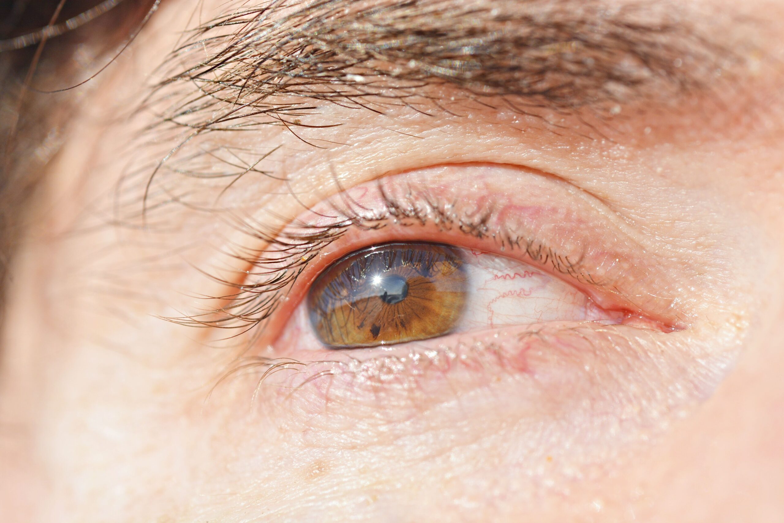 Why is my eye swollen when I wake up and common causes