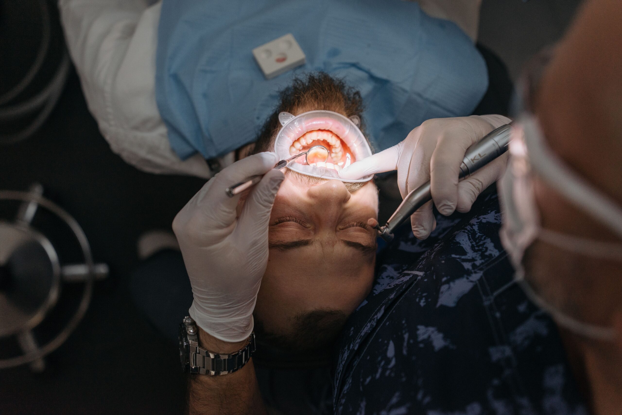 Why Does My Tooth Hurt After a Filling? Causes, Relief, and When to See a Dentist