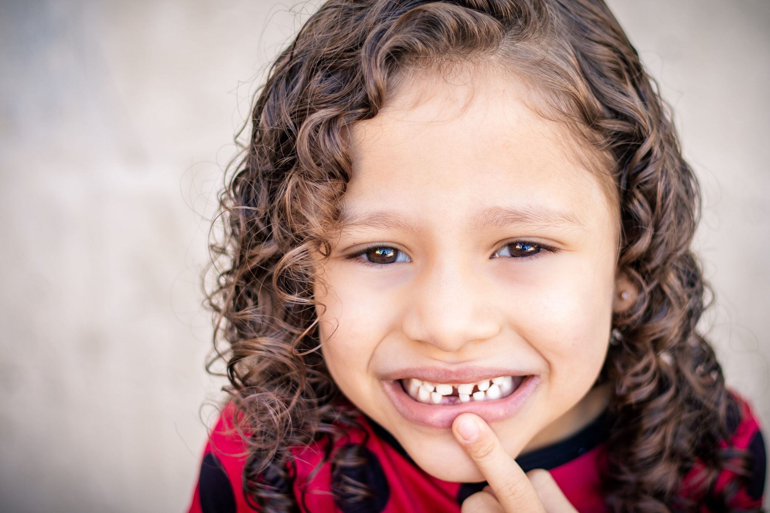 Wisdom Tooth Hole Never Closed Years Later Causes and What to Do