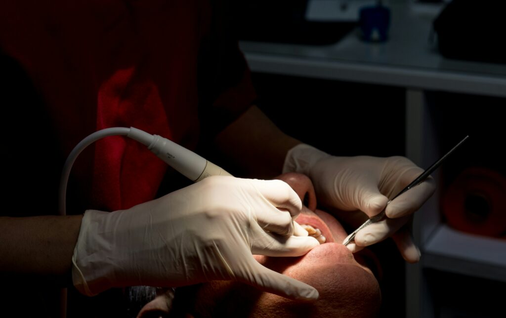 How to Squeeze Out Salivary Gland Stone Safely What You Can Try at Home showing gentle self-care, hydration, warm compresses, and oral hygiene.